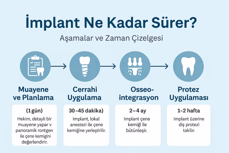 İmplant Ne Kadar Sürer? Aşamalar ve Zaman Çizelgesi